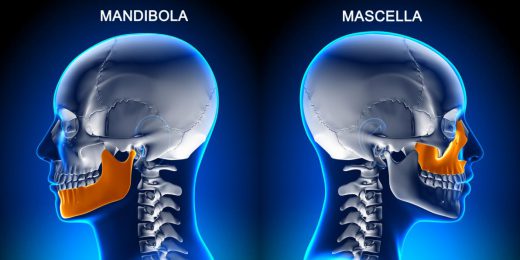 frattura mandibola e mascellare