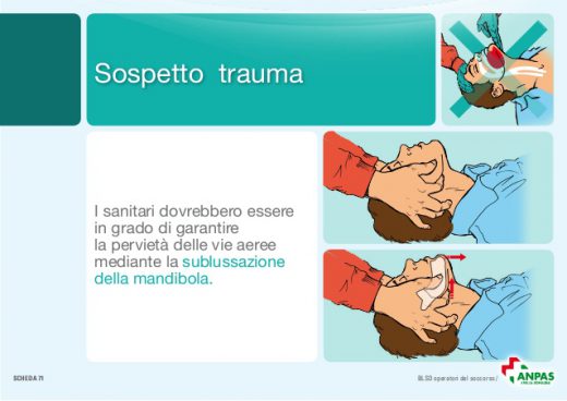 Sublussazioni: cosa sono?